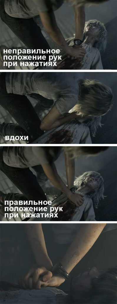 Сердечно-лёгочная реанимация в массмедиа